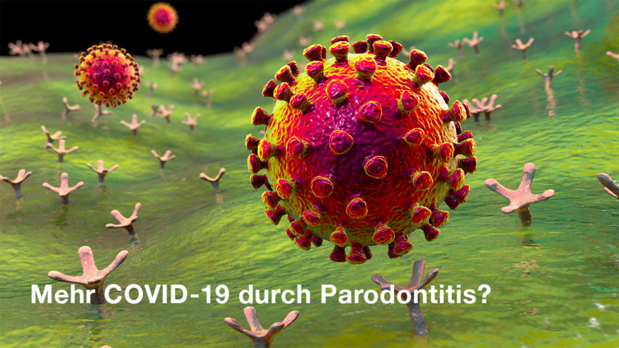Mehr COVID-19 durch Parodontitis?