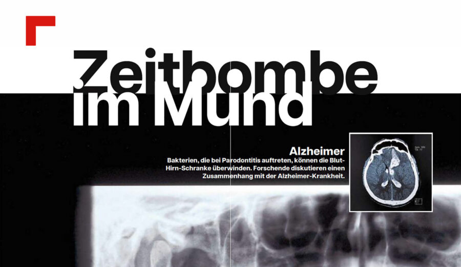 “profil – wissen”: Zeitbombe im Mund